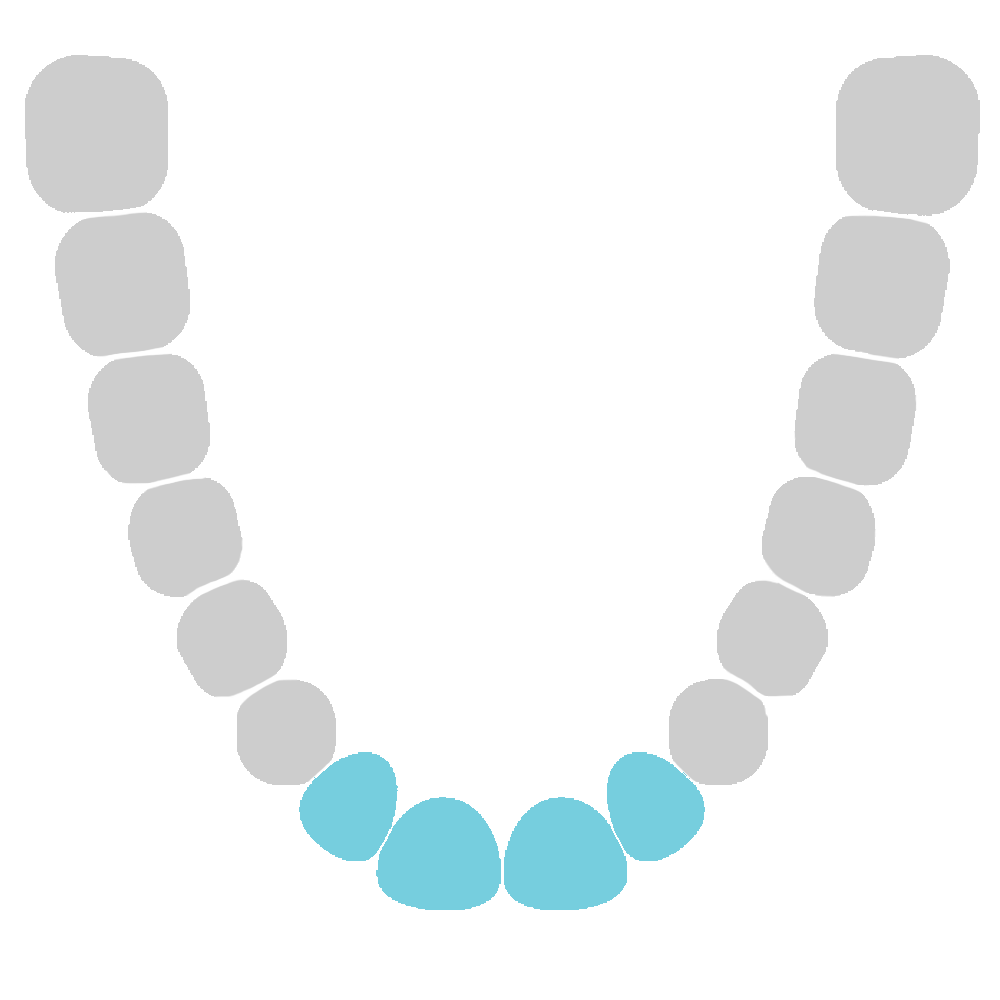 Incisors and Roots - Lower Jaw