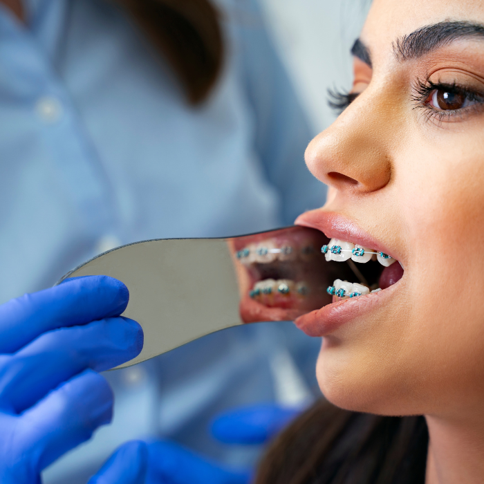 Dental Photographic Mirrors