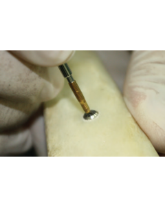 Neobiotech Fixture Remover Screw in use