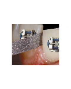 Edenta Non-Serrated Diamond Finishing Strips