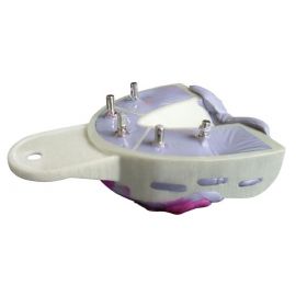Miratray Implant Impression Tray