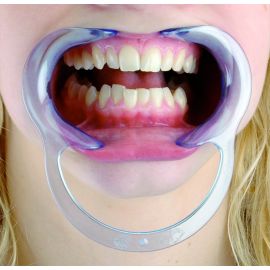 Spandex Cheek & Lip Retractor