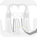 W&H Piezomed Tooth illustration