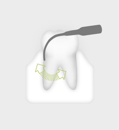 W&H Perio Tip 3Pl W&H Perio Tip 3Pl