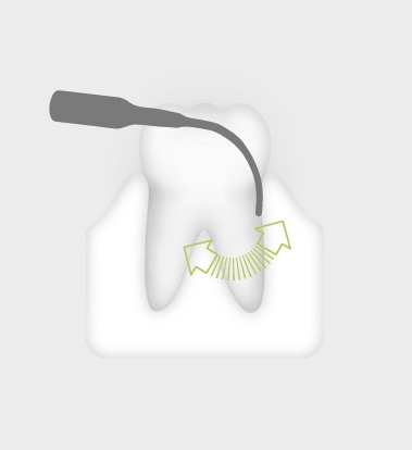 W&H Perio Tip 3Pr W&H Perio Tip 3Pr